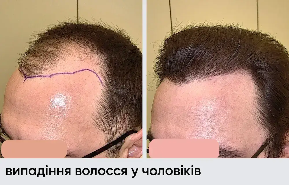 Головна 50
