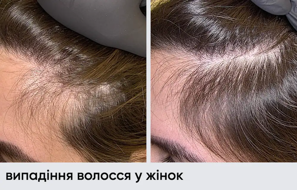 Головна 41