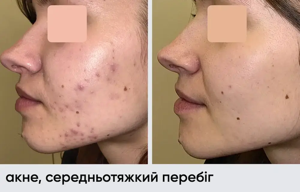 Головна 39