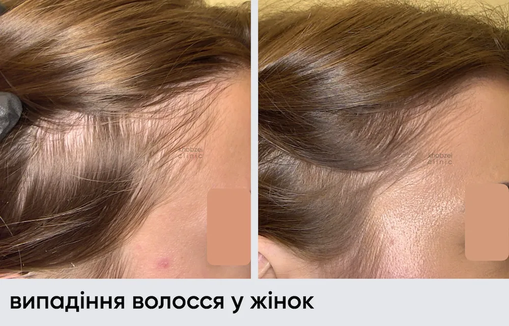 Головна 56